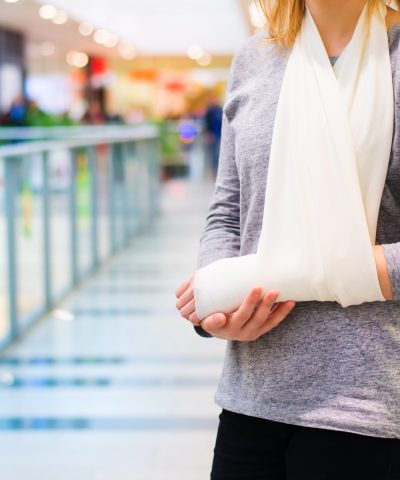Oficinas Legales De Sharona Eslamboly Woman with broken arm